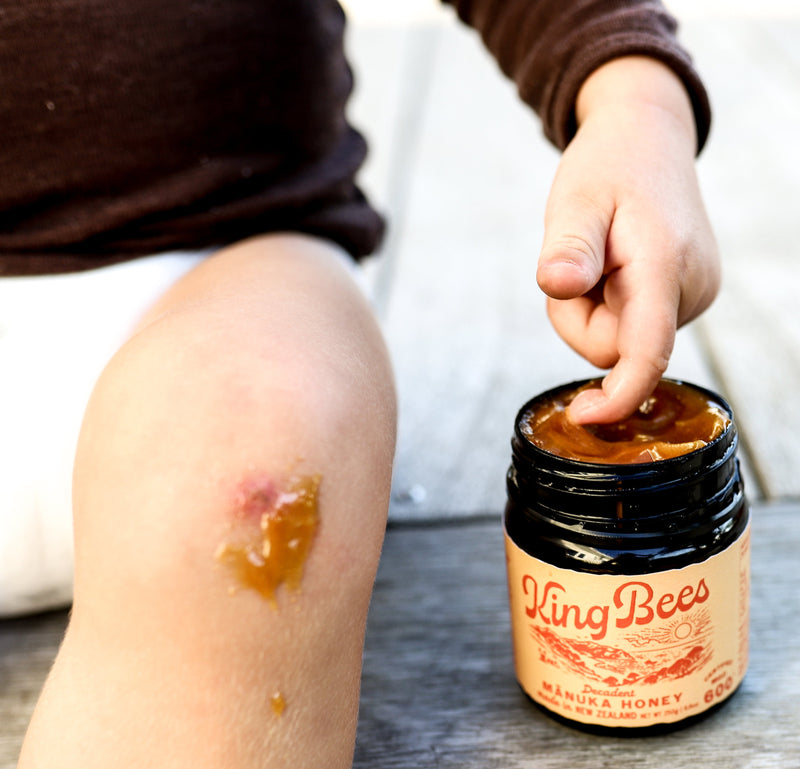 5 Natural Remedies Using Medicinal Honey at Home